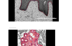 03 the integument structure and function Worksheet Real Anatomy The
