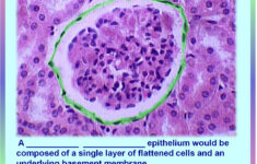 EPITHELIAL TISSUE Flashcards By ProProfs