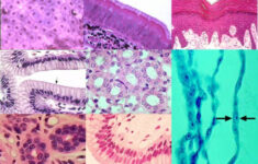 Epithelial Tissue Quizzes Fun Practice And Test