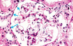Lab Histology Epithelial Tissue Flashcards Quizlet