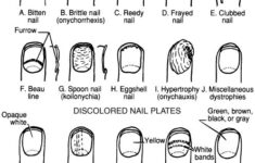 Nail Diagram Bing Images