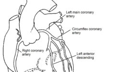 Normal Coronary Arteries Pediatric Heart Specialists