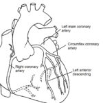 Normal Coronary Arteries Pediatric Heart Specialists