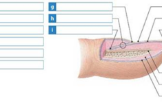 Solved Label The Structures Of A Typical Nail In The Accompany