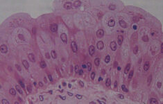 Tissue Pictures Flashcards Quizlet